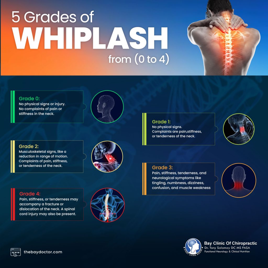 https://thebaydoctor.com/wp-content/uploads/2013/02/five-grades-of-whiplash-1024x1024.jpg?utm_source=chatgpt.com
